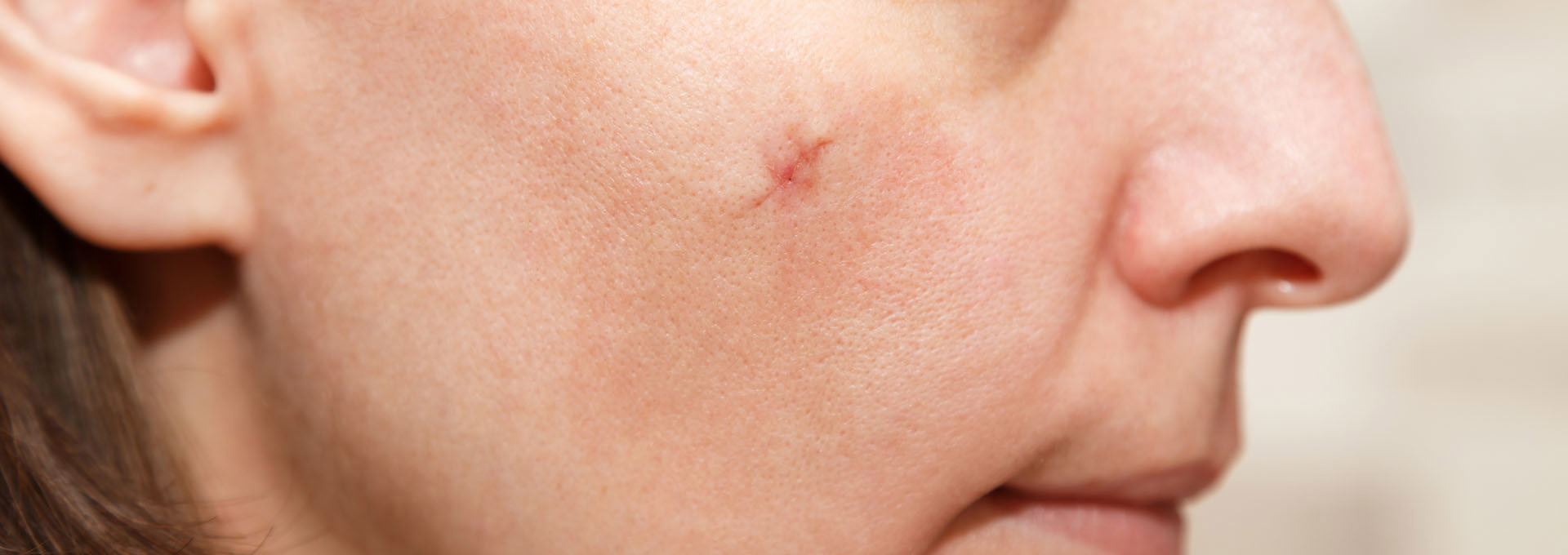 Gangnamseoyon Plastic Surgery