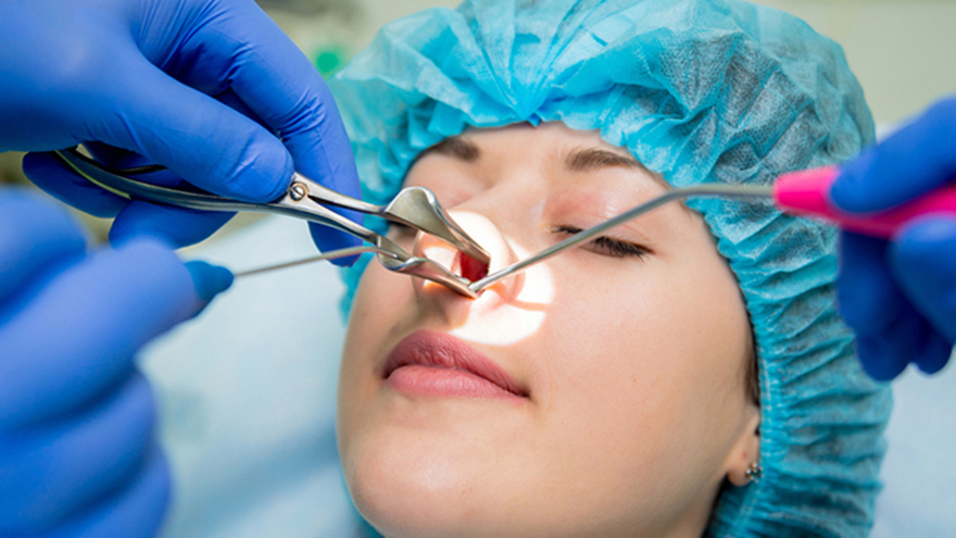 Can Rhinoplasty Improve Breathing