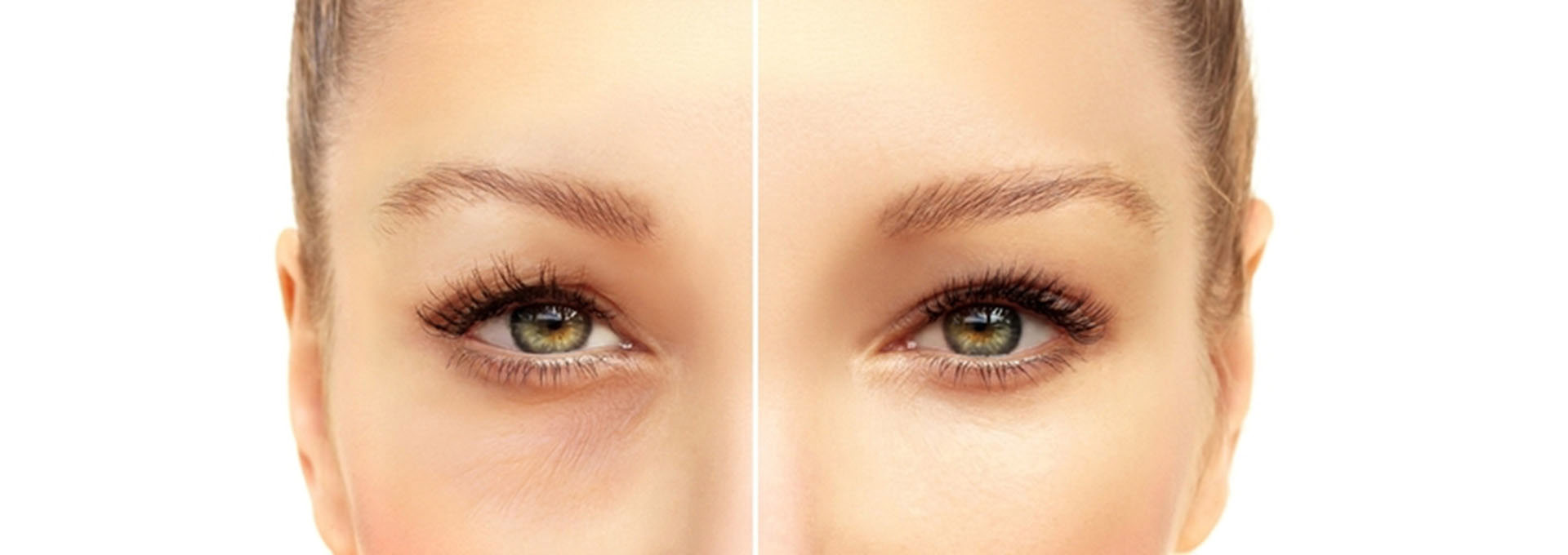 Gangnamseoyon Plastic Surgery