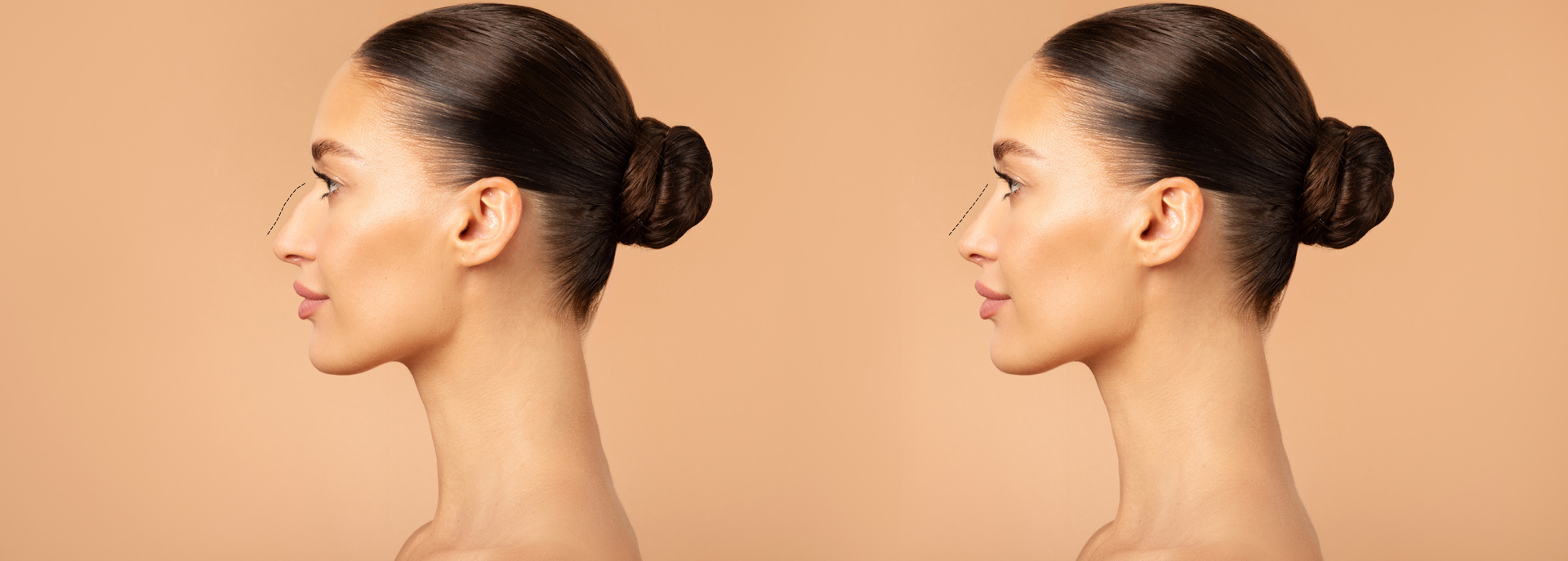 Gangnamseoyon Plastic Surgery